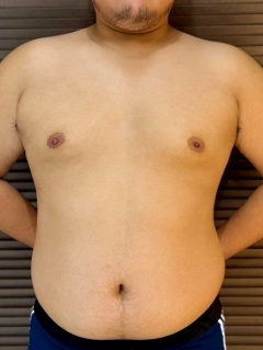 児玉