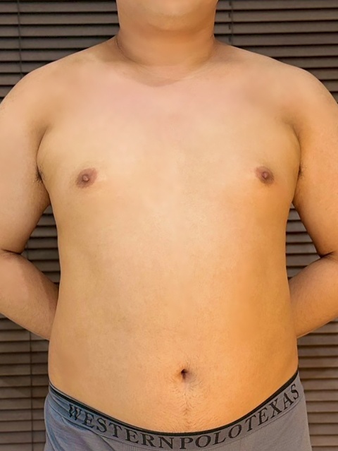 小林